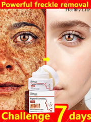 Dark Skin Quickly Brightening Cream Niacinamide Powerful Removal Melasma Emulsion Women Facial Brighten Cream Korean Skin Care