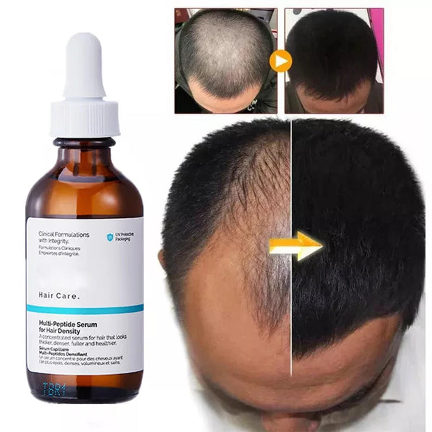 Hair Growth Serum 60ml Ordinary Original Authentic Hai Growth Essential Oils Care Essence Hair Loss Liquid Peptide Treatment