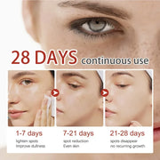 Dark Skin Quickly Brightening Cream Niacinamide Powerful Removal Melasma Emulsion Women Facial Brighten Cream Korean Skin Care